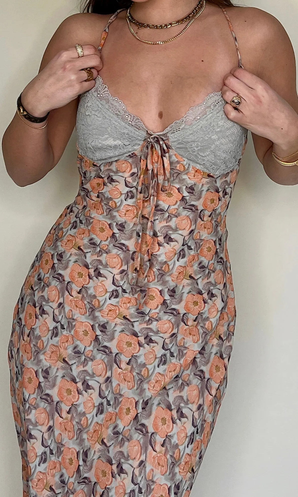 St Bart's Dress